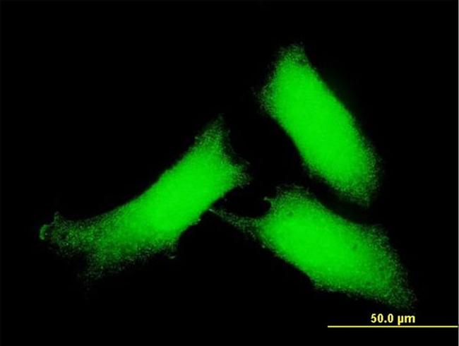 CAMK2D Antibody in Immunocytochemistry (ICC/IF)