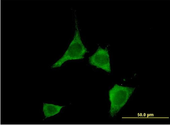 CAMK2D Antibody in Immunocytochemistry (ICC/IF)