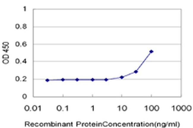 CAMK2D Antibody in ELISA (ELISA)