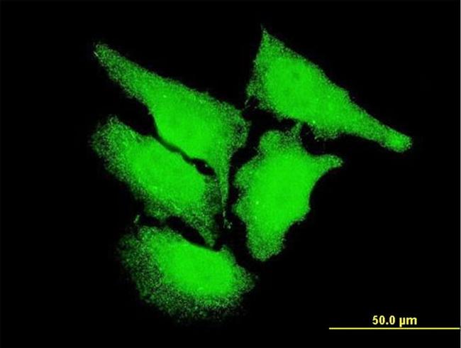 CAMK2D Antibody in Immunocytochemistry (ICC/IF)