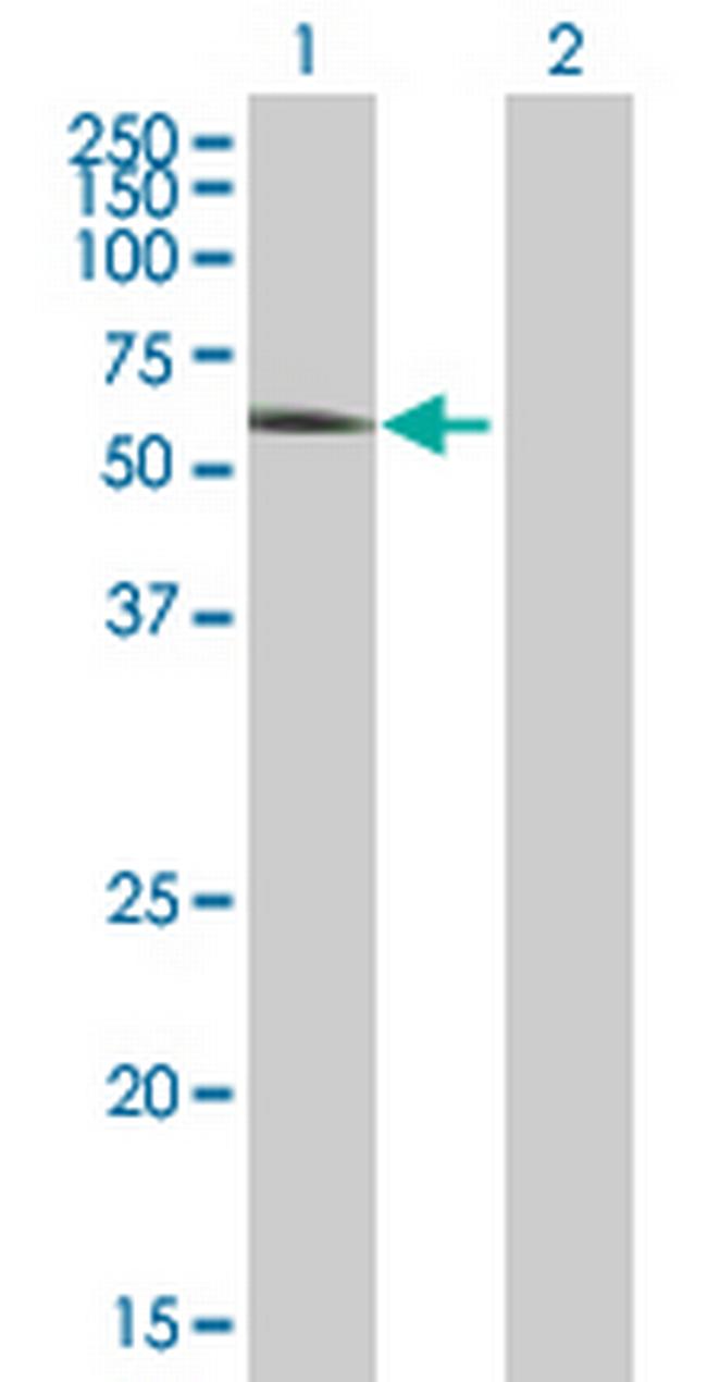 CAMK2G Antibody in Western Blot (WB)