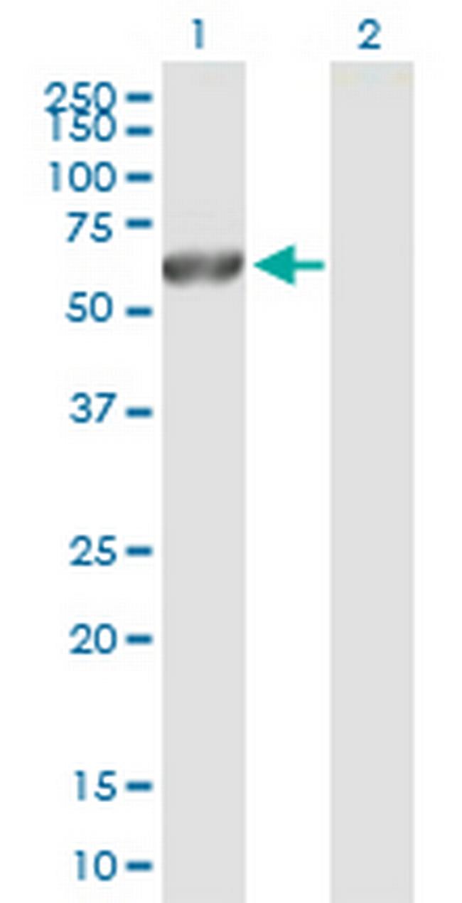 CAMK2G Antibody in Western Blot (WB)