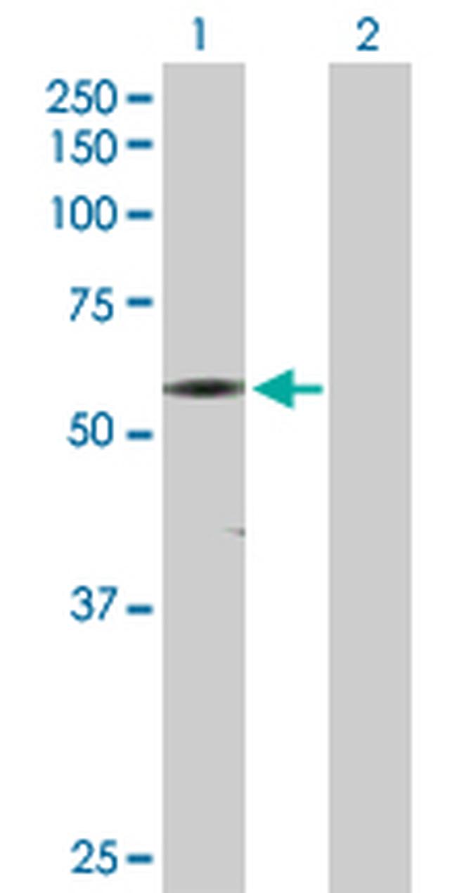 CAMK2G Antibody in Western Blot (WB)