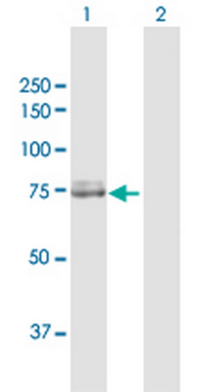 CAPN2 Antibody in Western Blot (WB)