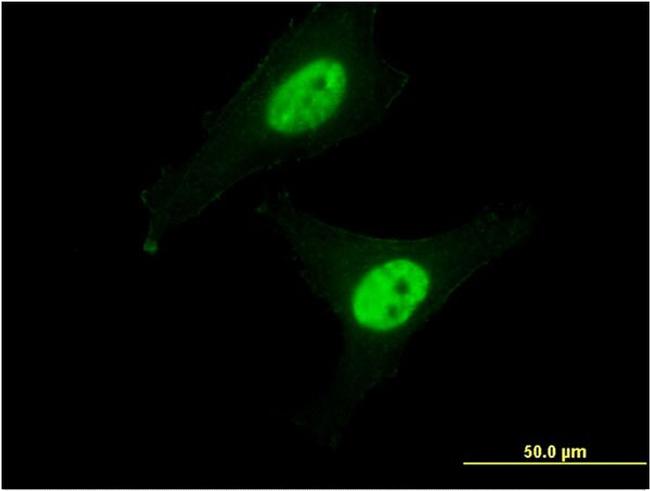 CAPN3 Antibody in Immunocytochemistry (ICC/IF)