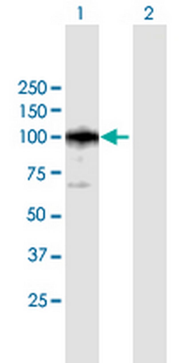 CAST Antibody in Western Blot (WB)