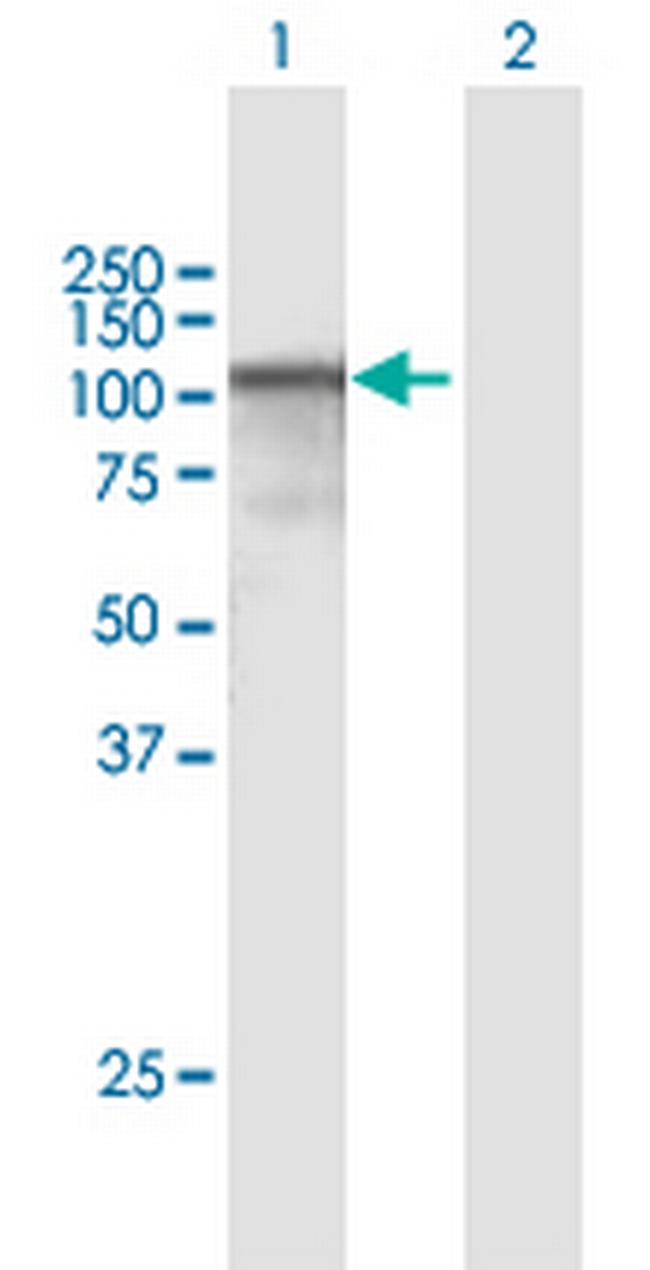 CAST Antibody in Western Blot (WB)