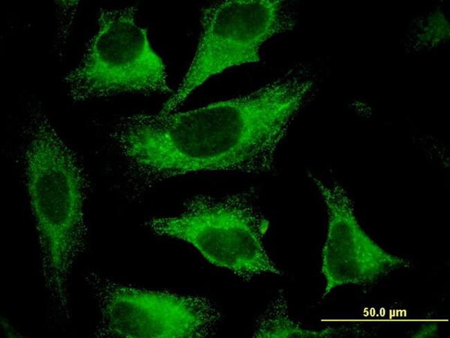 CAST Antibody in Immunocytochemistry (ICC/IF)