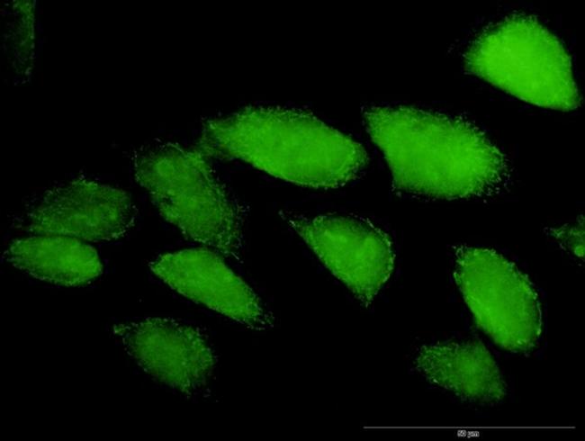 CASP3 Antibody in Immunocytochemistry (ICC/IF)