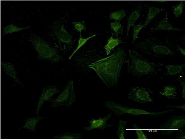 CASP10 Antibody in Immunocytochemistry (ICC/IF)