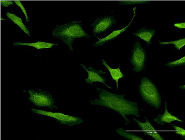 CASP10 Antibody in Immunocytochemistry (ICC/IF)