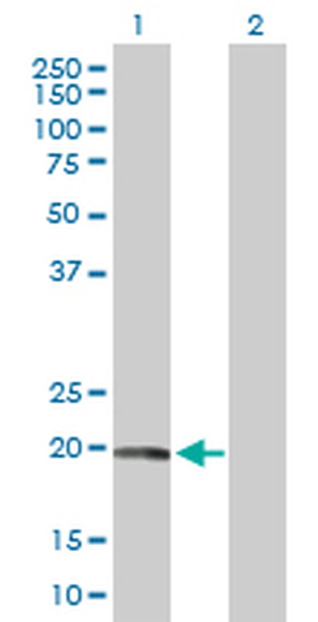 CAV1 Antibody in Western Blot (WB)