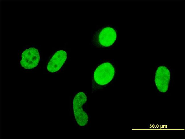 RUNX1 Antibody in Immunocytochemistry (ICC/IF)