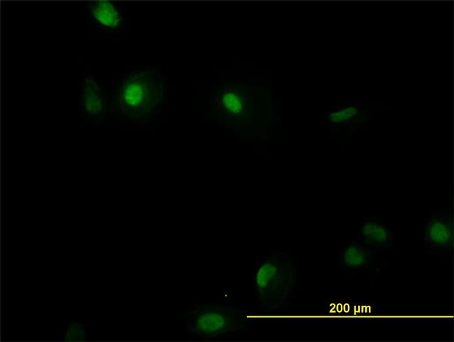 RUNX1 Antibody in Immunocytochemistry (ICC/IF)