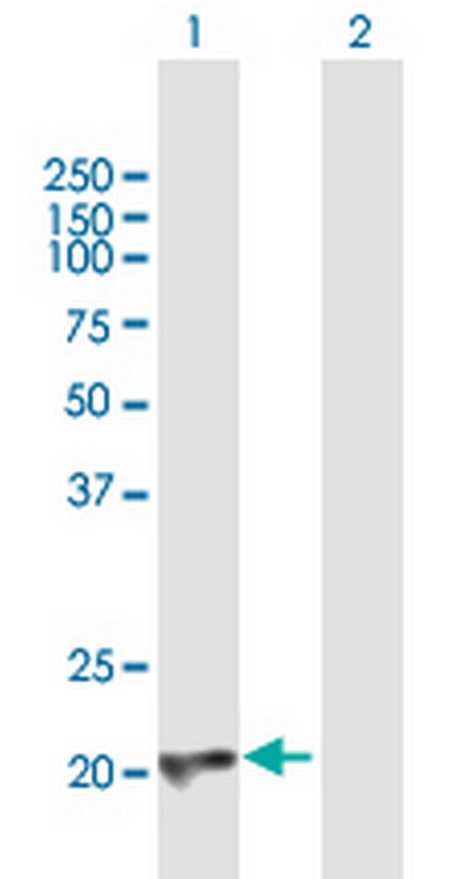 CBFB Antibody in Western Blot (WB)