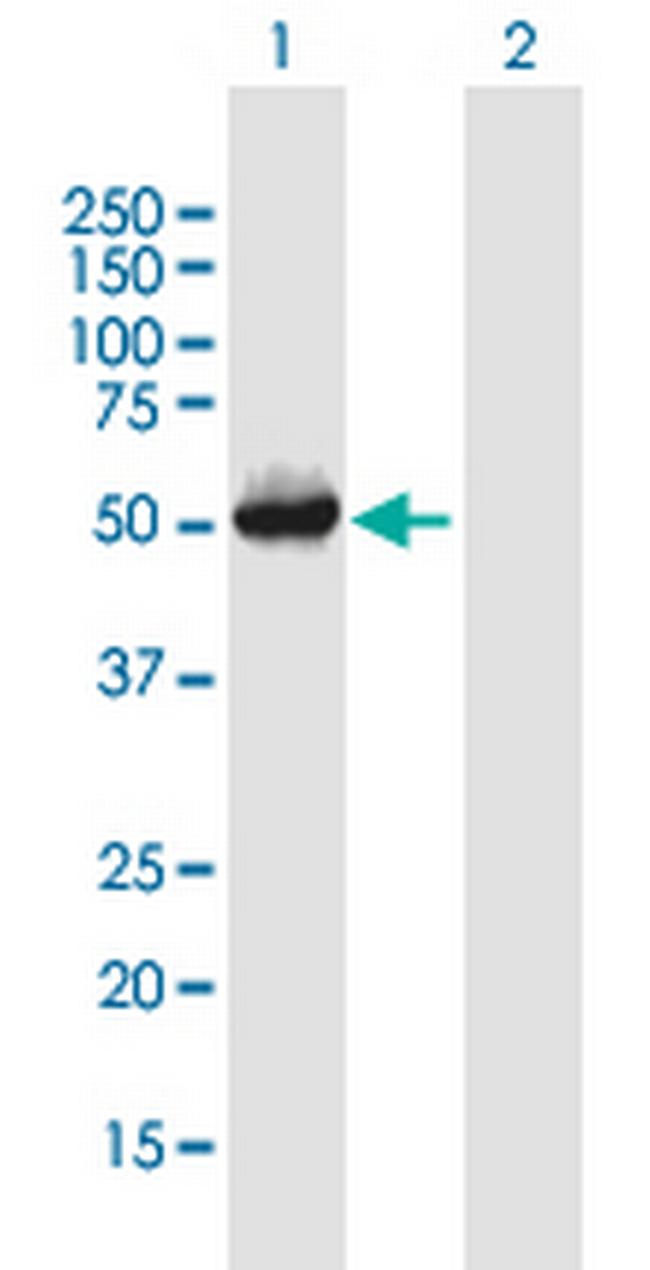 SERPINH1 Antibody in Western Blot (WB)