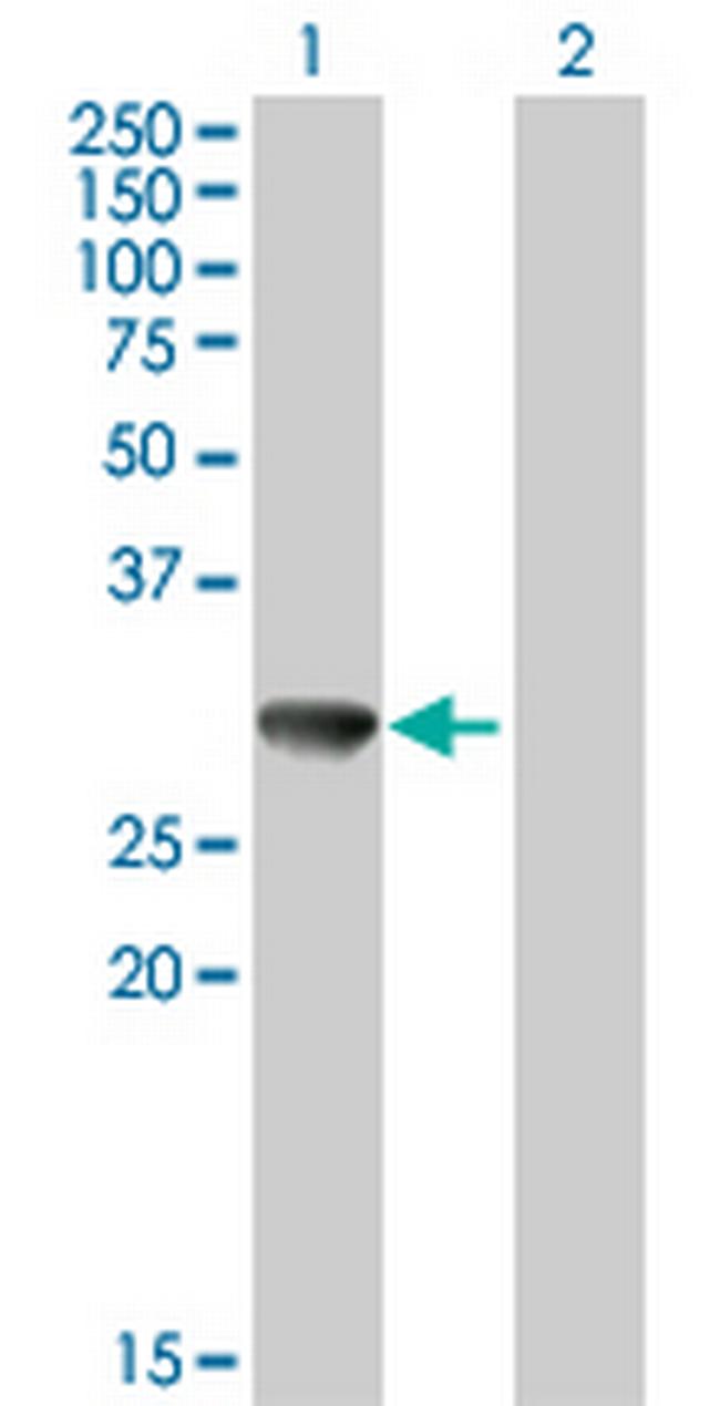 CBR3 Antibody in Western Blot (WB)