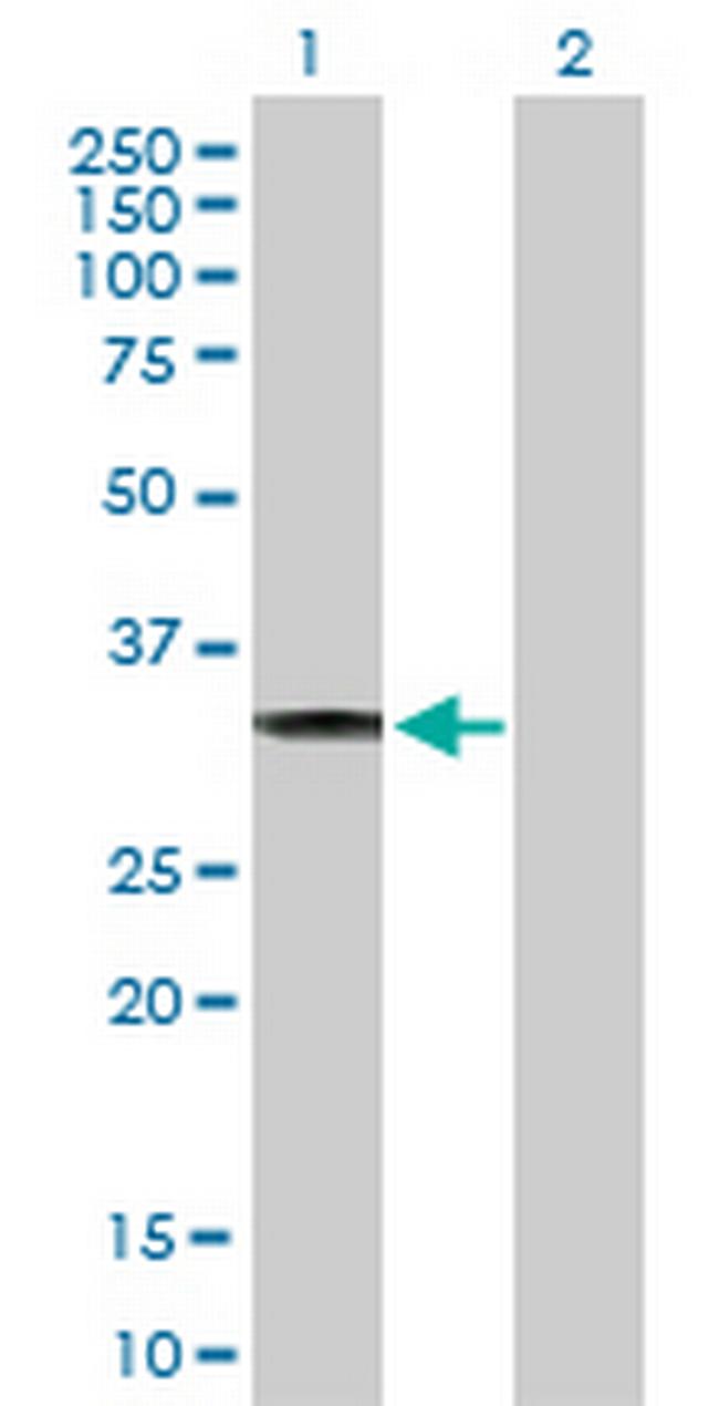 CBR3 Antibody in Western Blot (WB)