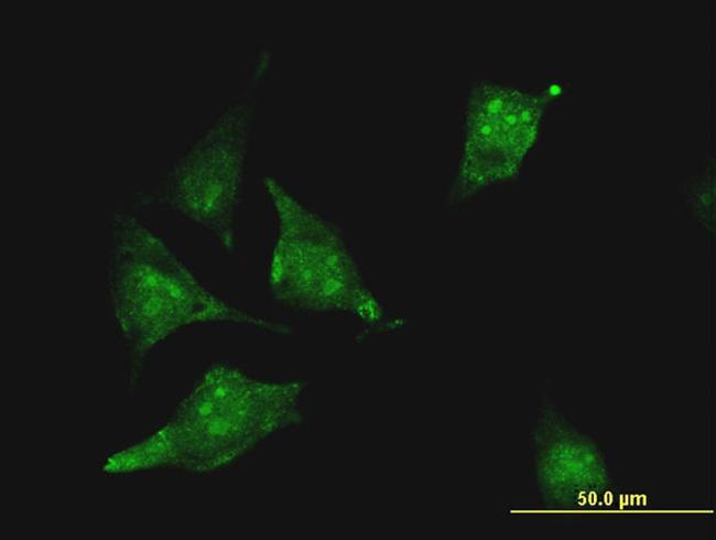 CBS Antibody in Immunocytochemistry (ICC/IF)