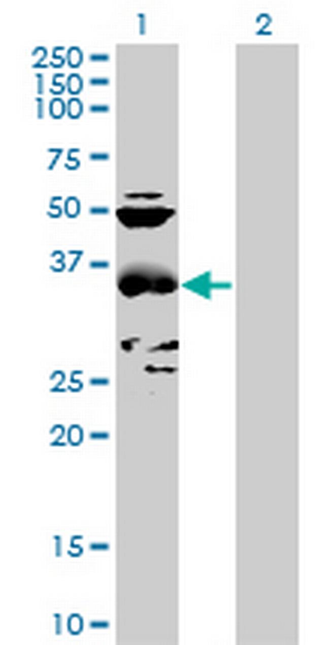 CCBL1 Antibody in Western Blot (WB)