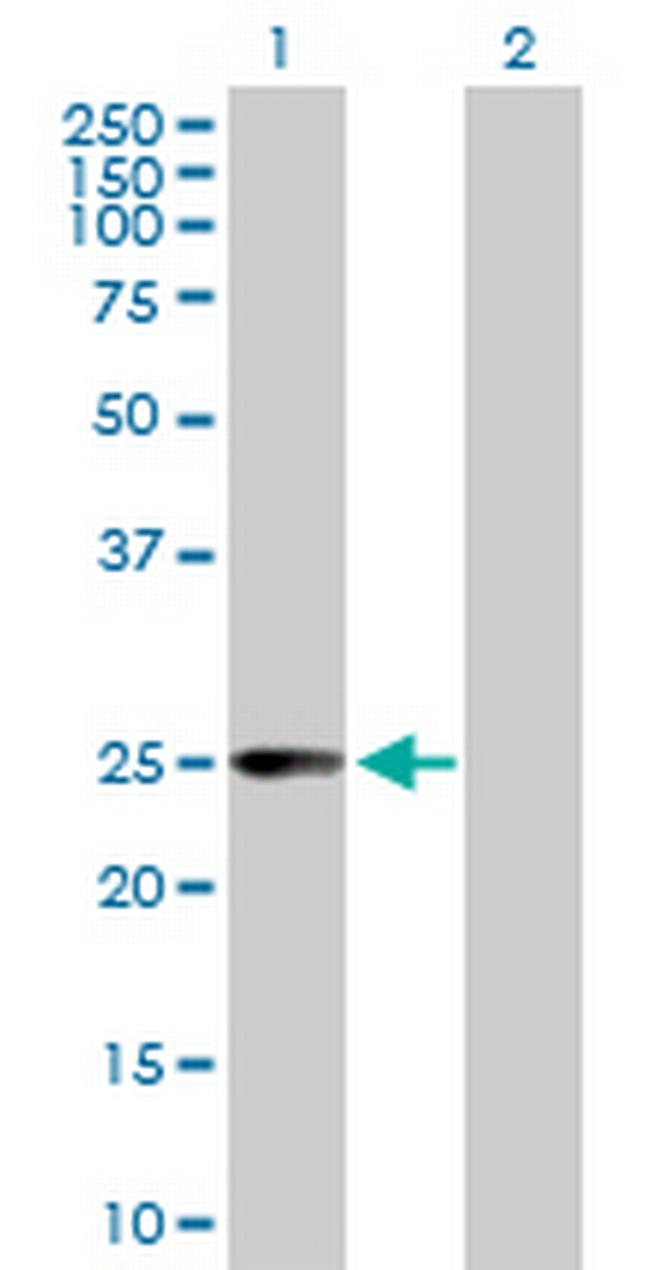 CCBL1 Antibody in Western Blot (WB)