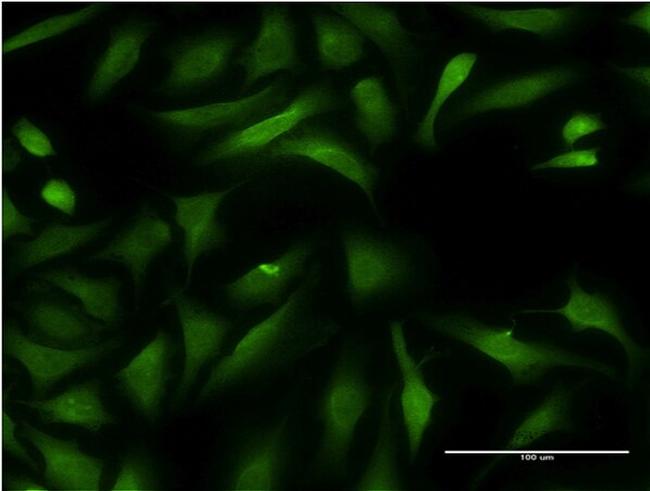 CCBL1 Antibody in Immunocytochemistry (ICC/IF)