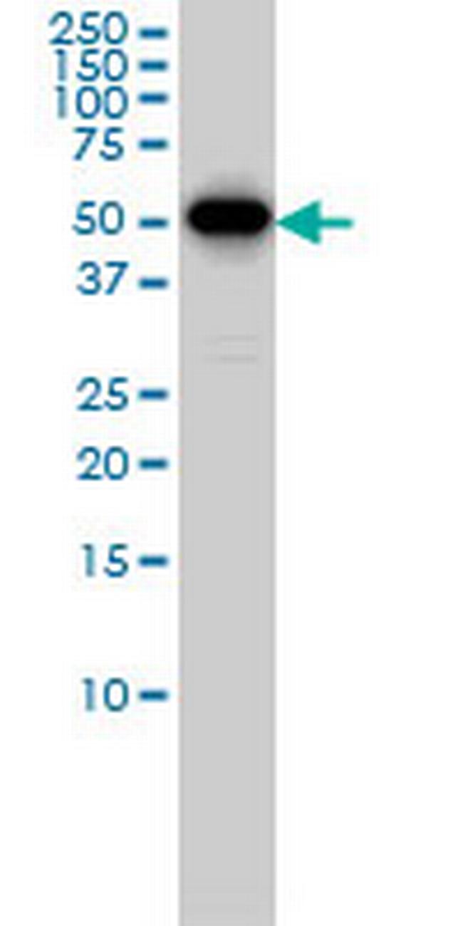 CCNB1 Antibody in Western Blot (WB)