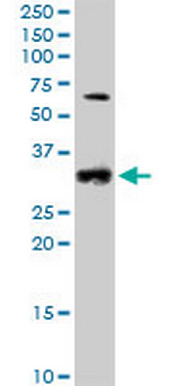 CCND2 Antibody in Western Blot (WB)