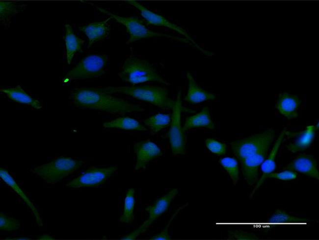 CCND2 Antibody in Immunocytochemistry (ICC/IF)