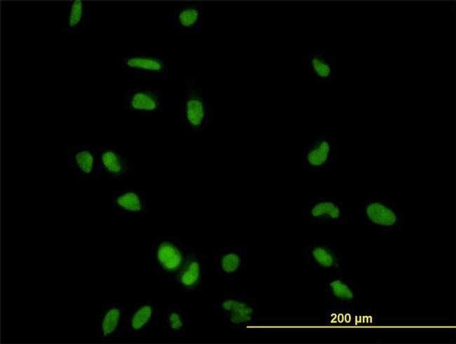 CCNH Antibody in Immunocytochemistry (ICC/IF)