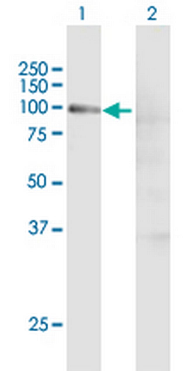 CCNT1 Antibody in Western Blot (WB)