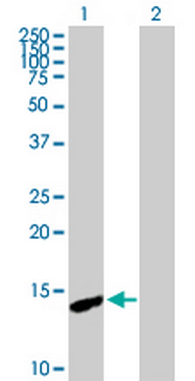 CDA Antibody in Western Blot (WB)