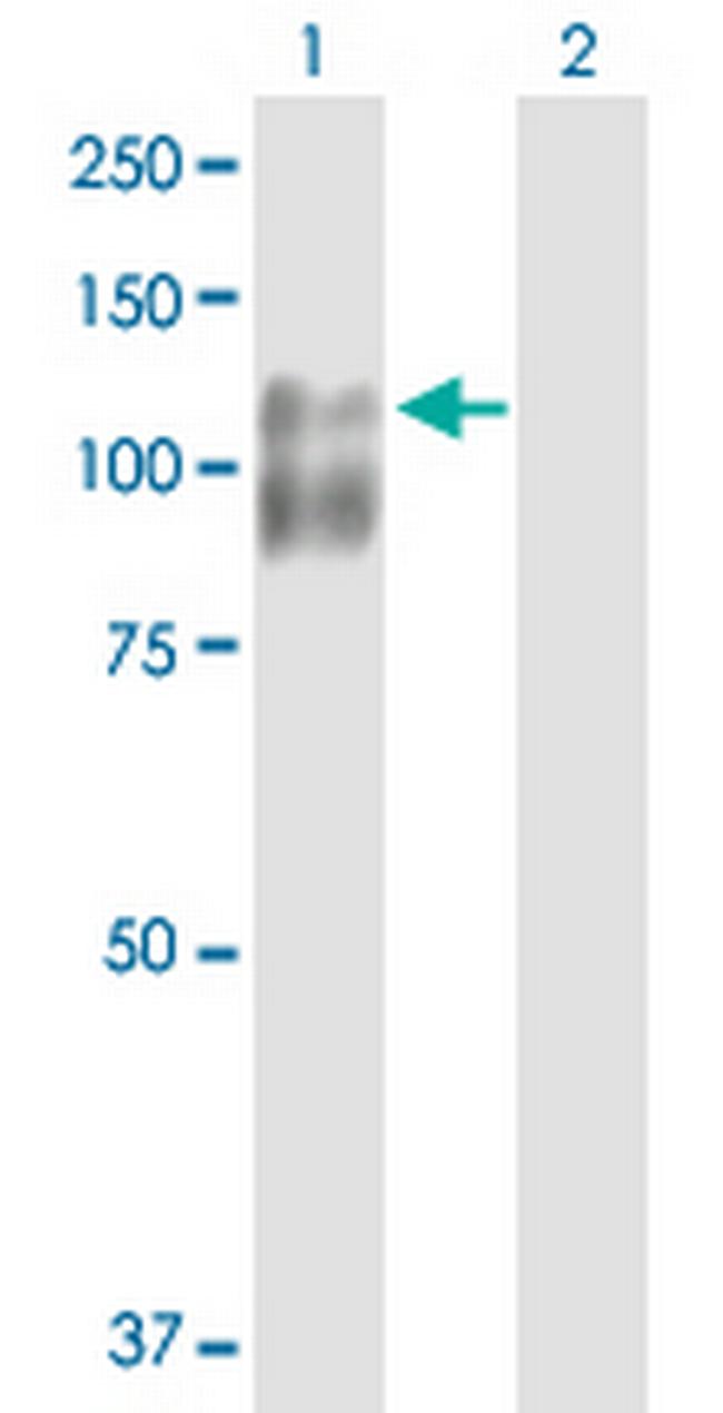 CDH3 Antibody in Western Blot (WB)