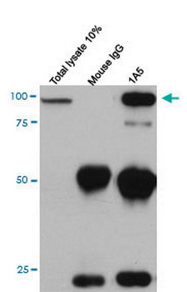 CDH11 Antibody in Immunoprecipitation (IP)