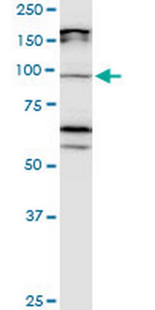 CDH11 Antibody in Western Blot (WB)