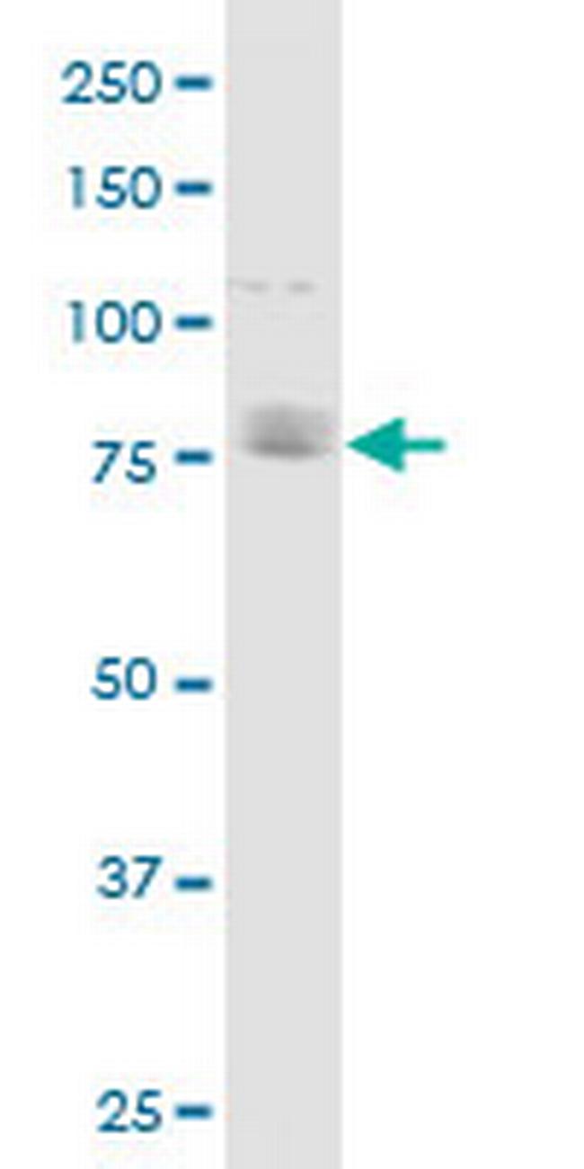 CDH11 Antibody in Western Blot (WB)