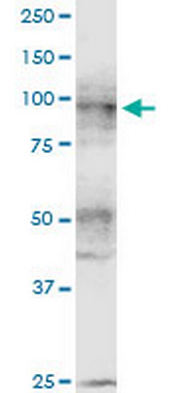 CDH11 Antibody in Western Blot (WB)