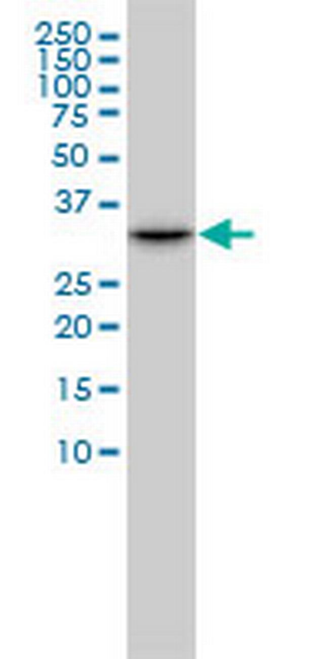 CDK2 Antibody in Western Blot (WB)