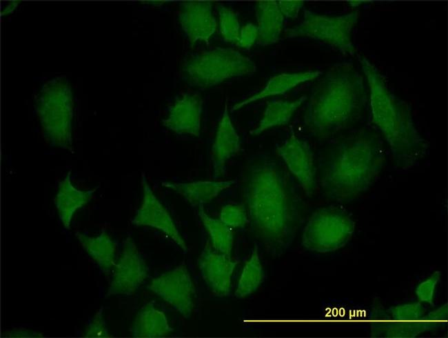 CDK4 Antibody in Immunocytochemistry (ICC/IF)