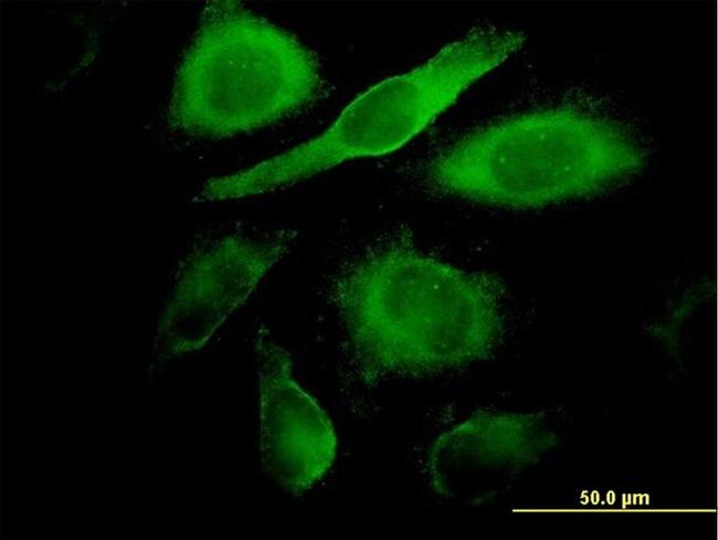 CDK4 Antibody in Immunocytochemistry (ICC/IF)