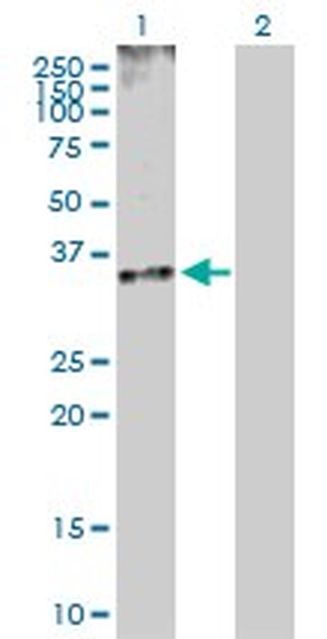 CDK5 Antibody in Western Blot (WB)