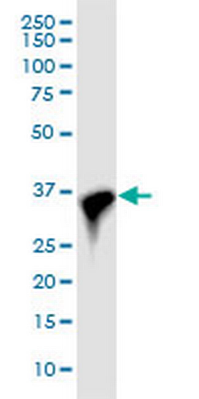 CDK6 Antibody in Western Blot (WB)