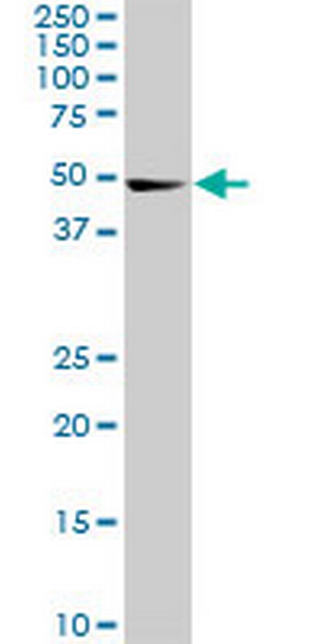 CDK8 Antibody in Western Blot (WB)