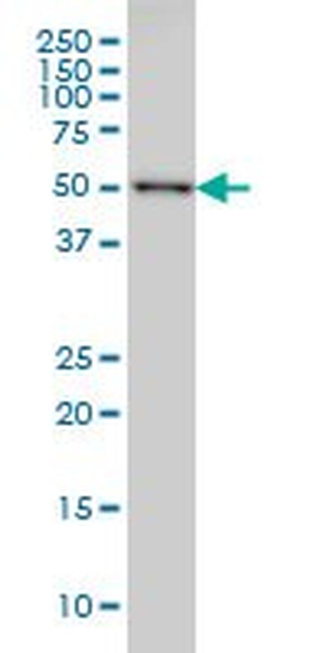 CDK8 Antibody in Western Blot (WB)