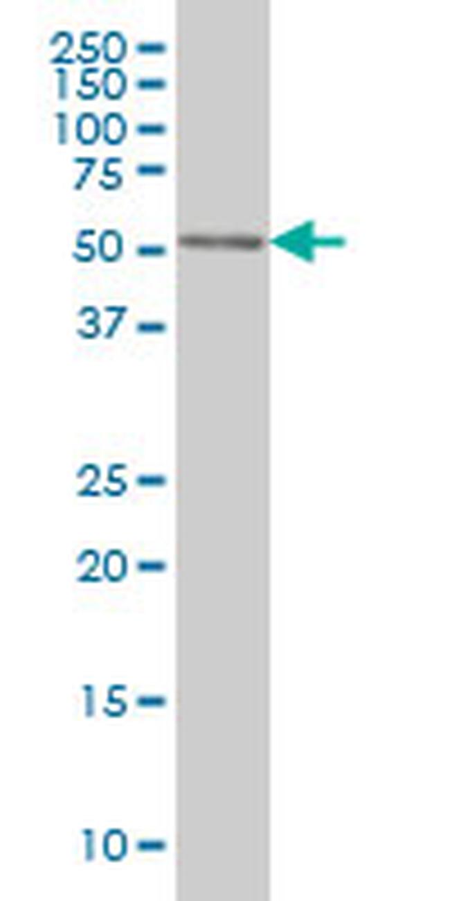 CDK8 Antibody in Western Blot (WB)