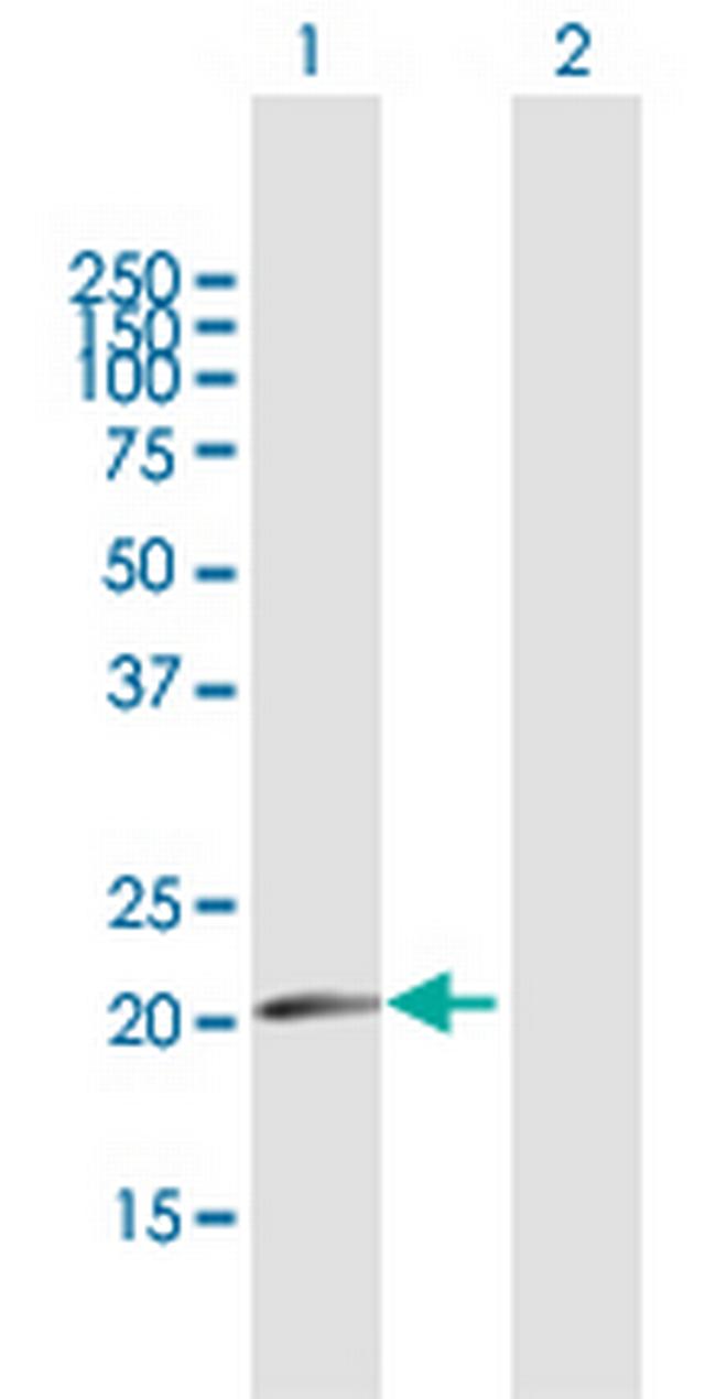 CDKN1A Antibody in Western Blot (WB)