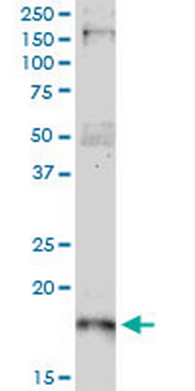 CDKN1A Antibody in Western Blot (WB)