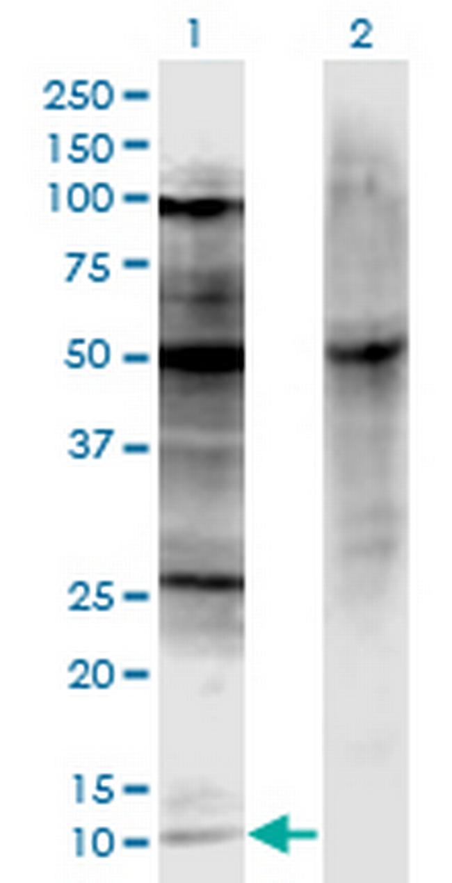 CDKN2A Antibody in Western Blot (WB)