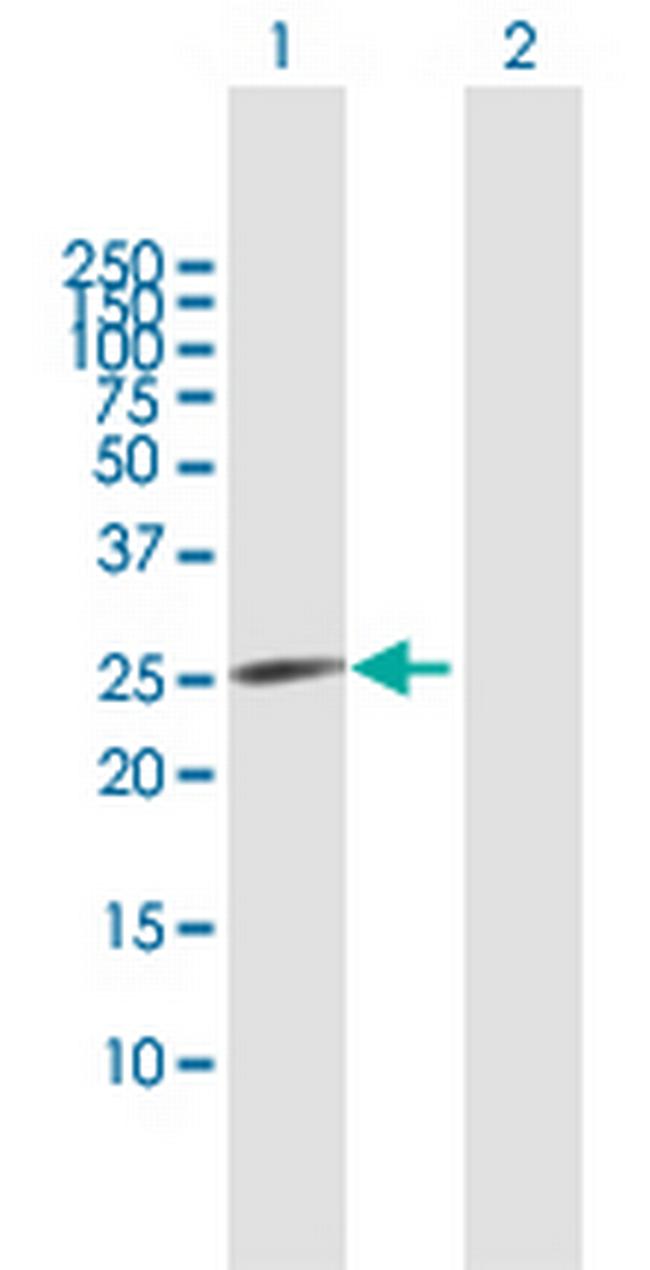 CDKN3 Antibody in Western Blot (WB)