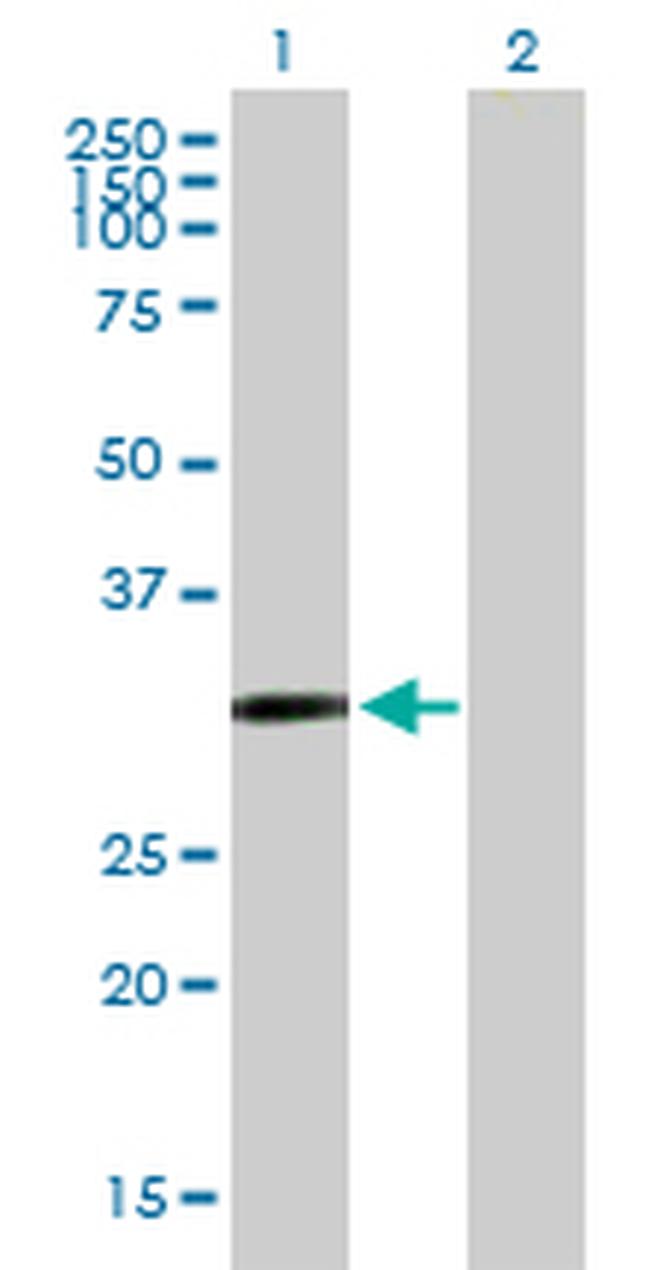 CDO1 Antibody in Western Blot (WB)